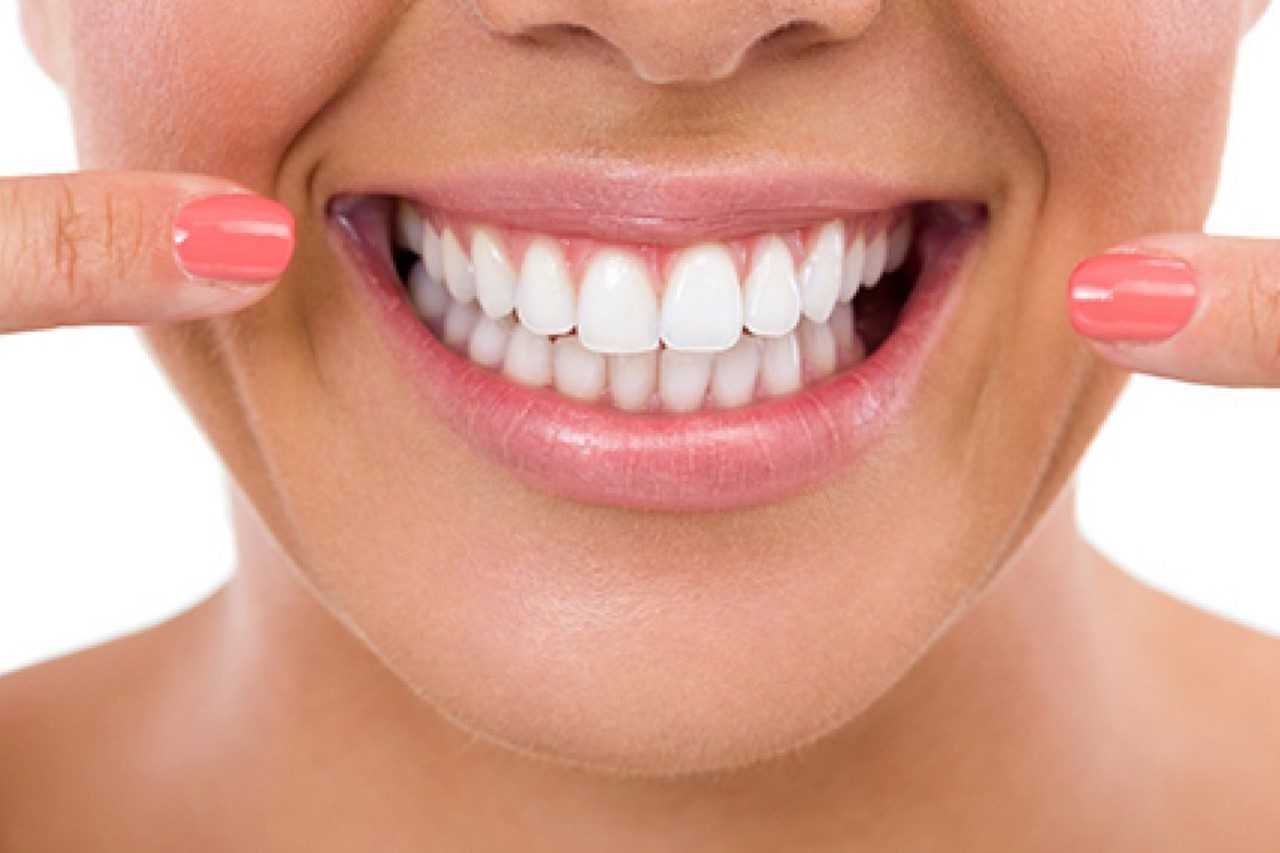 ایمپلنت دندان