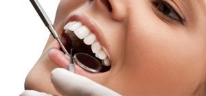 لمینت دندان در کلینیک