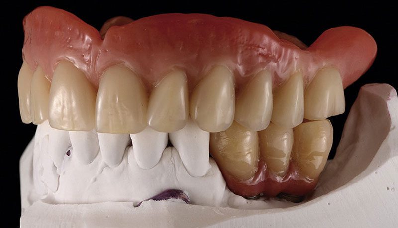 بهترین-کلینیک-تخصصی-اوردنچر-دندان-در-تهران