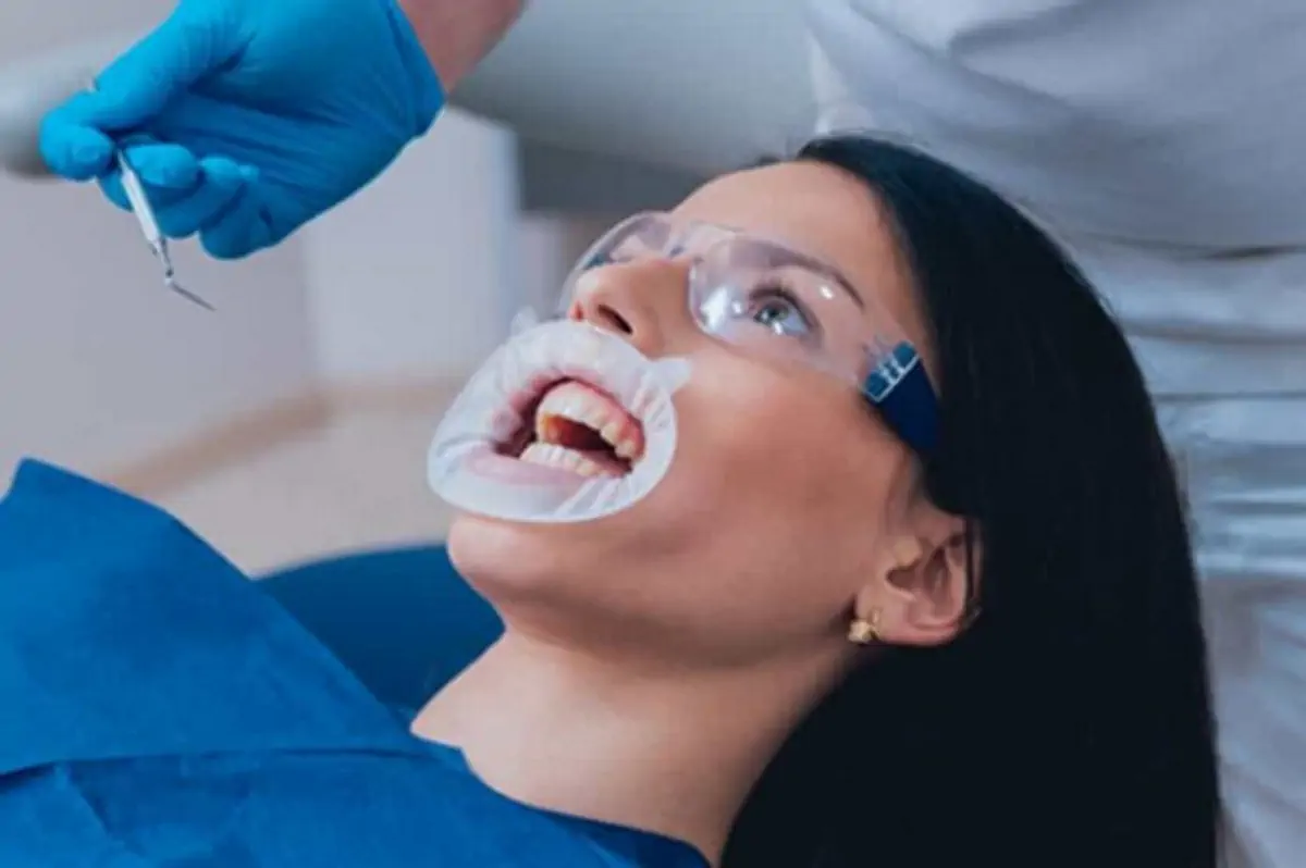 جراحی دهان و دندان