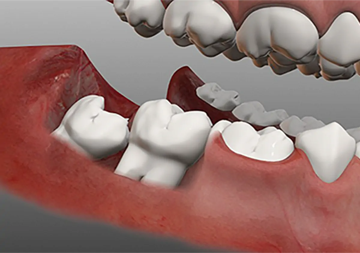 جراحی دهان و دندان