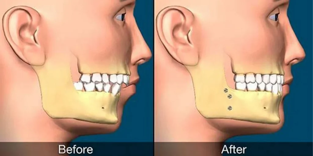 مراقبت از جراحی فک