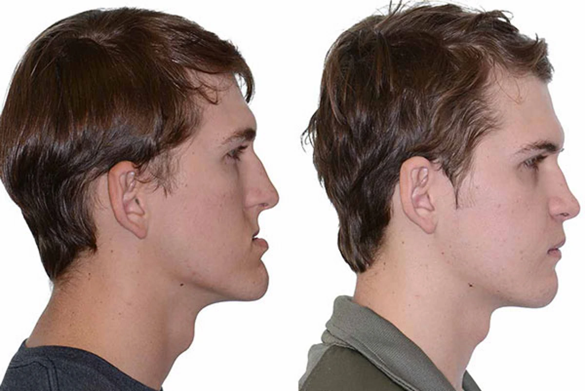 مراقبت از جراحی فک