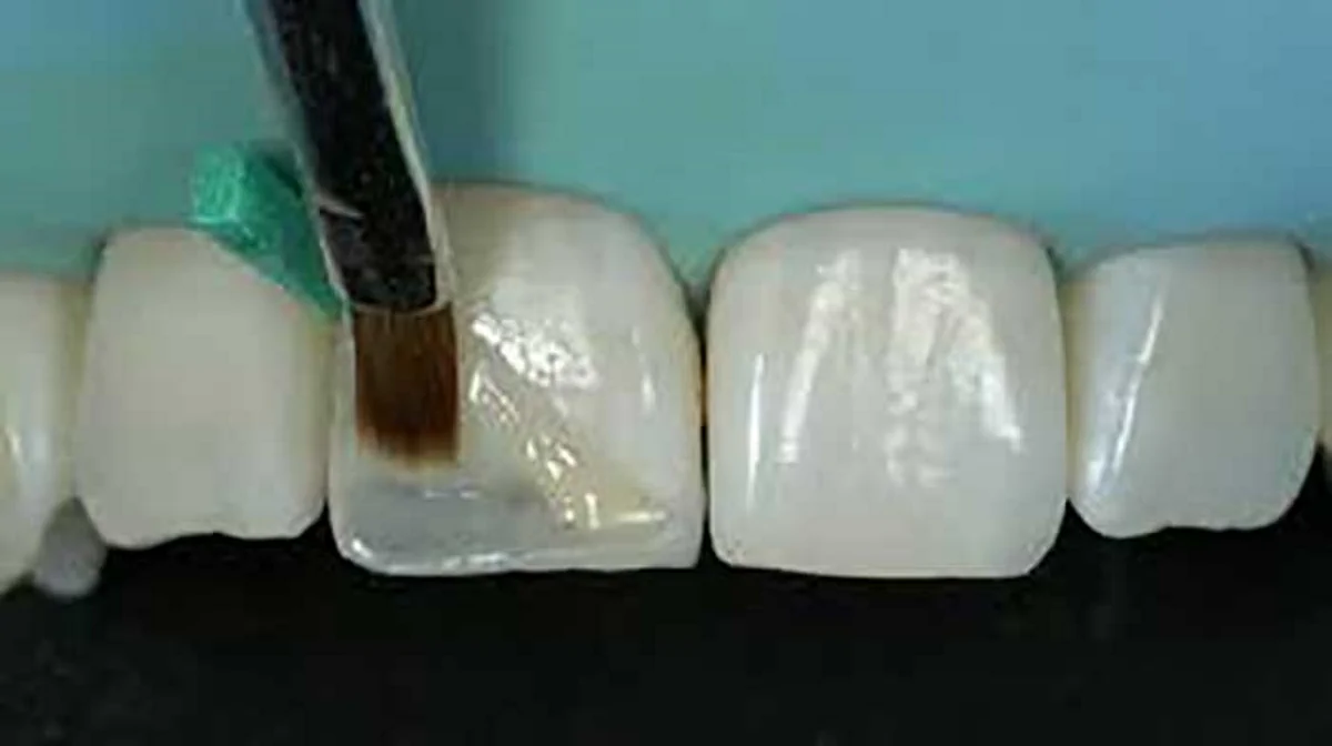 پولیش کامپوزیت