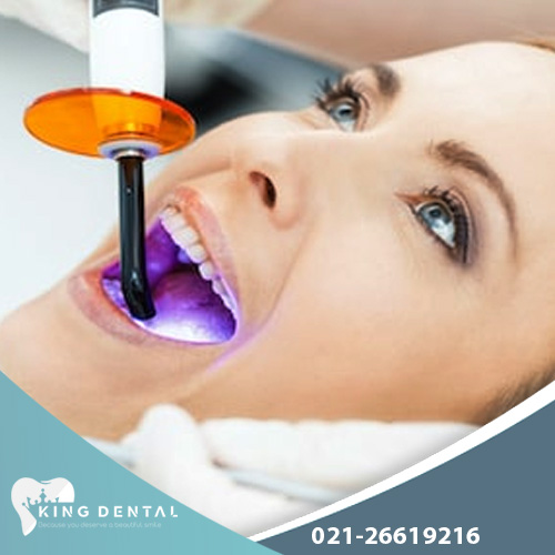 پلاسما تراپی دندان در غرب تهران