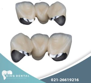 روکش پی اف ار