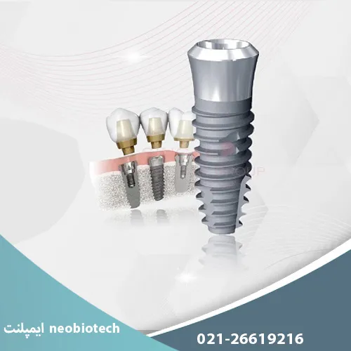 ایمپلنت neobiotech