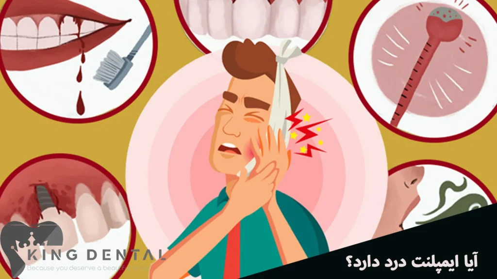 آیا ایمپلنت دندان درد دارد؟