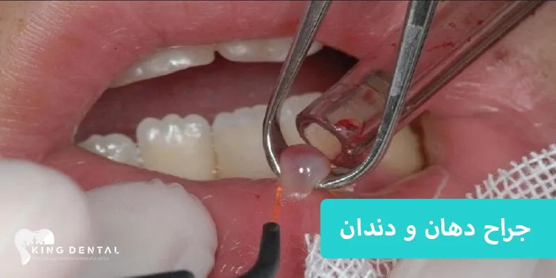 جراح دهان و دندان 