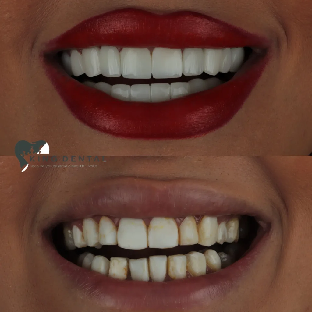 کامپوزیت دندان سعادت اباد