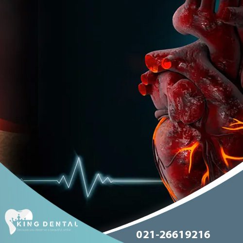 تاثیر عفونت بر سلامت دندنا