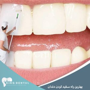 راه های سفیدی دندان