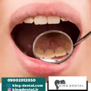 10 مورد از اشتباهاتی که سبب آسیب جدی به دندان می شود