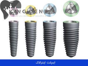 ایمپلنت اینترالاک