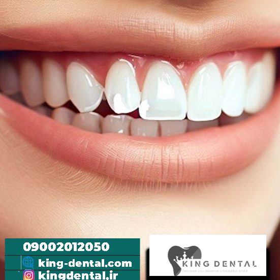ایمپلنت دندان در تهرانپارس تهران