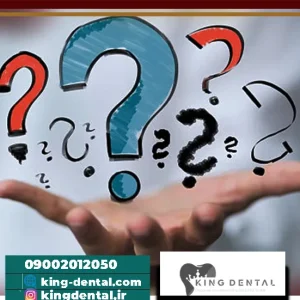 سوالات افراد در مورد ایمپلنت دندان