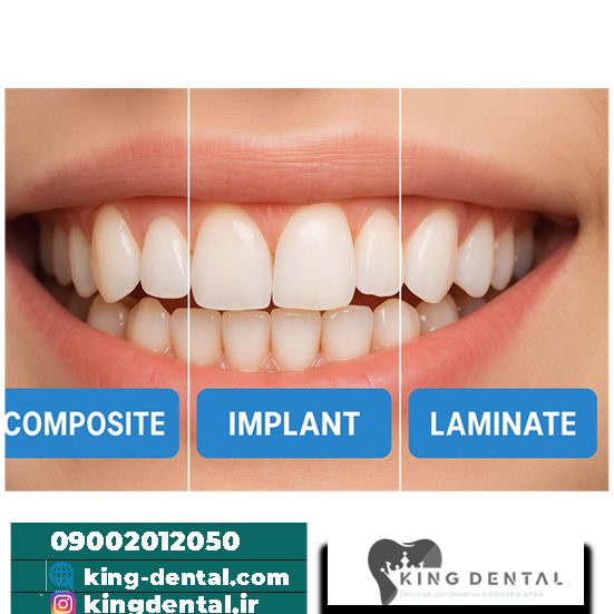 خدمات دندانپزشکی غرب تهران