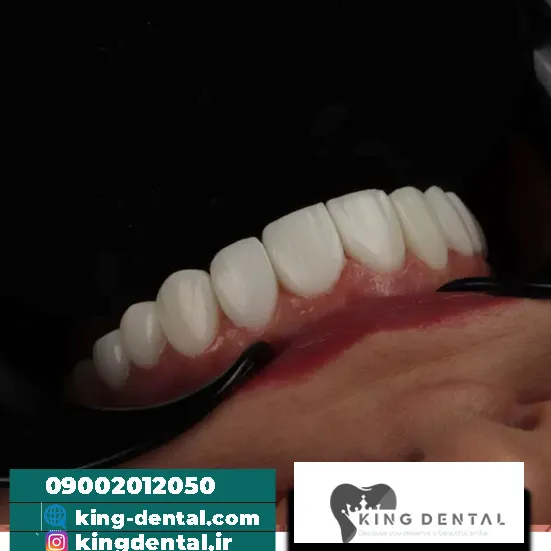 کامپوزیت دندان در میرداماد تهران