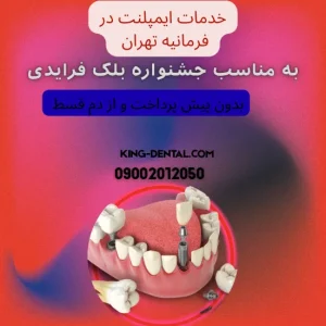 ایمپلنت دندان در فرمانیه تهران