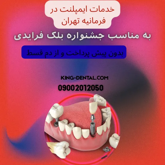 ایمپلنت دندان در فرمانیه تهران