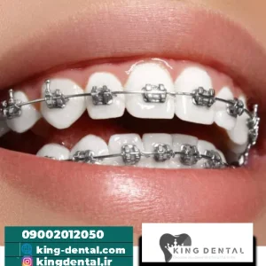 ارتودنسی دندان در غرب تهران