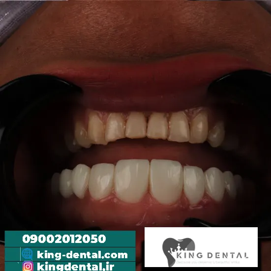 کامپوزیت (16)