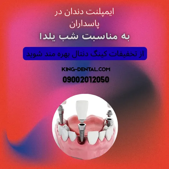 ایمپلنت دندان در پاسداران تهران
