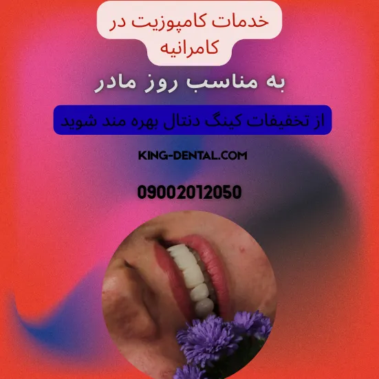 کامپوزیت دندان در کامرانیه تهران