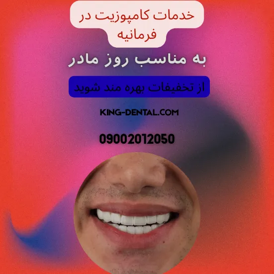 کامپوزیت دندان در فرمانیه تهران