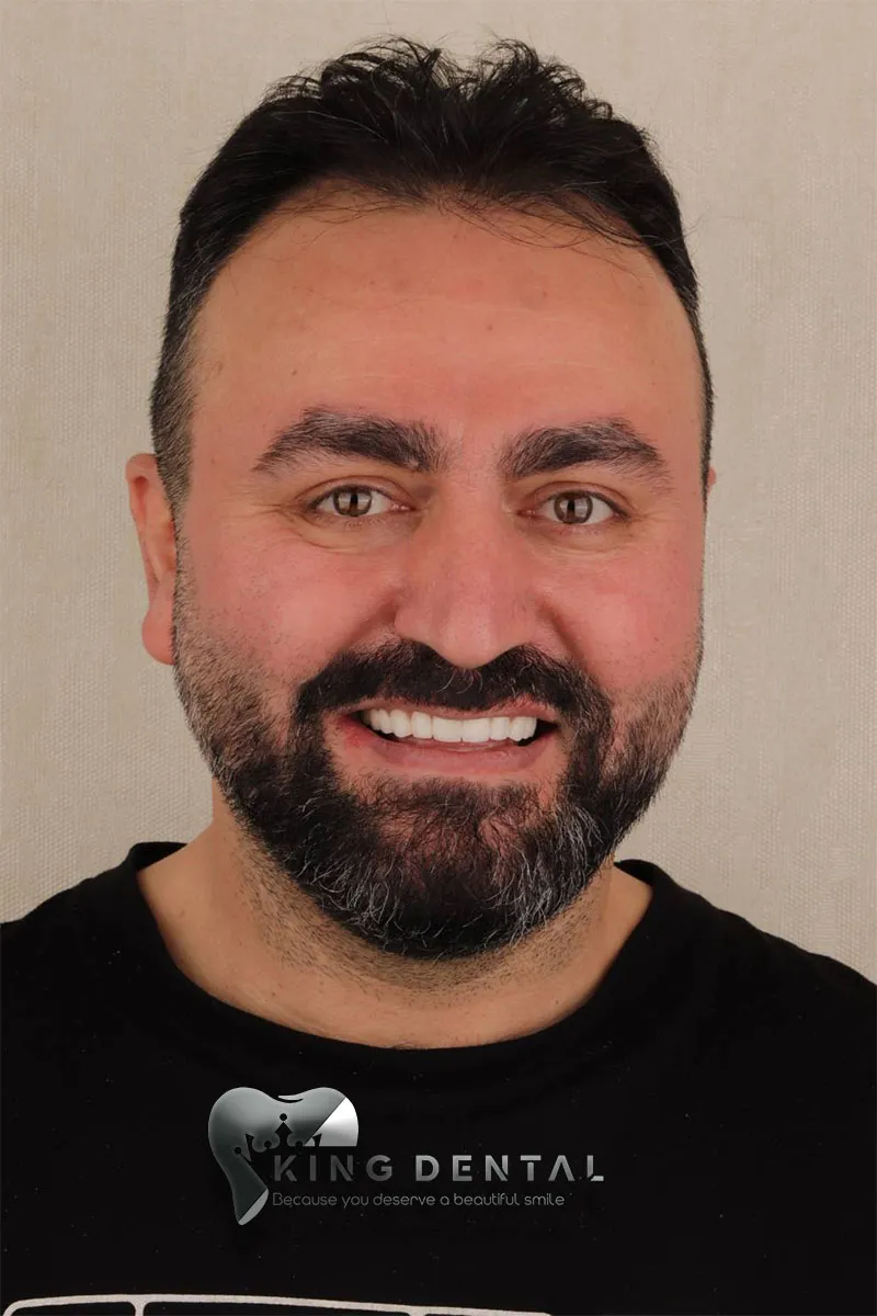 Client Smiles at King Dental 2
