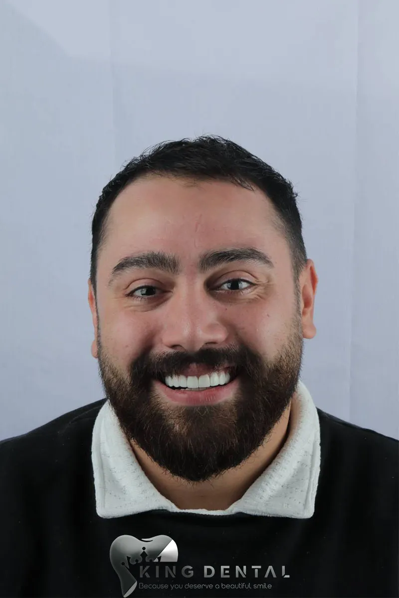 Client Smiles at King Dental 21