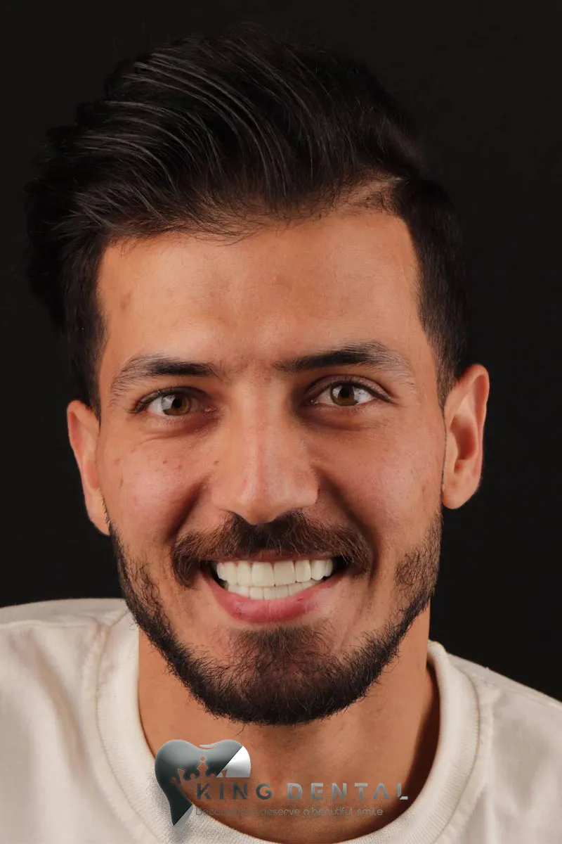 Client Smiles at King Dental 5