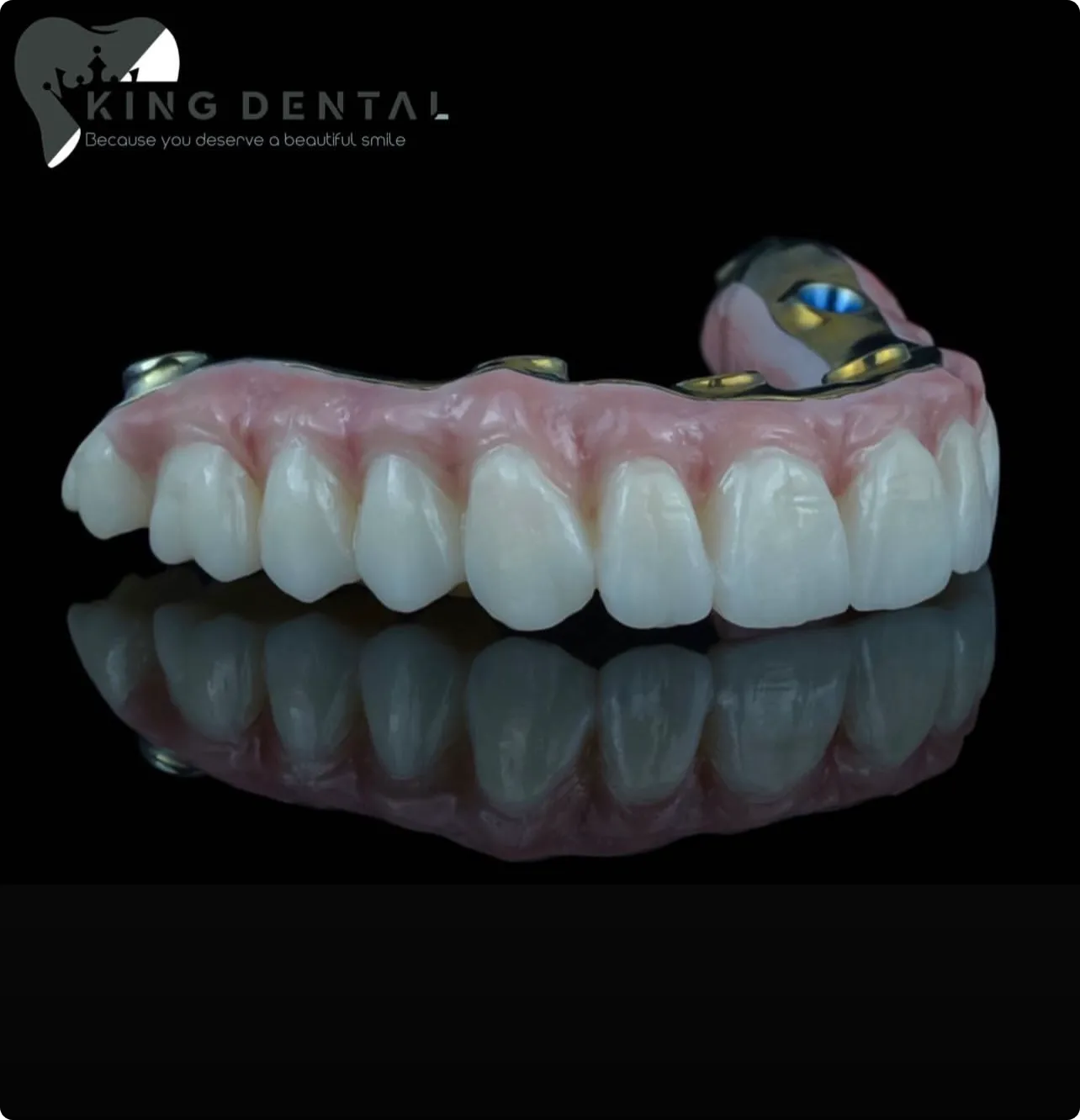 Prosthodontics Portfolio 11