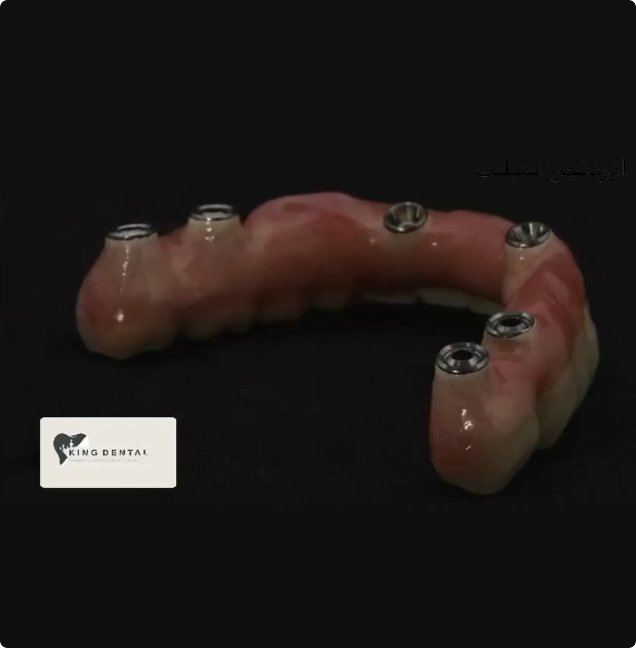 Prosthodontics Portfolio 3