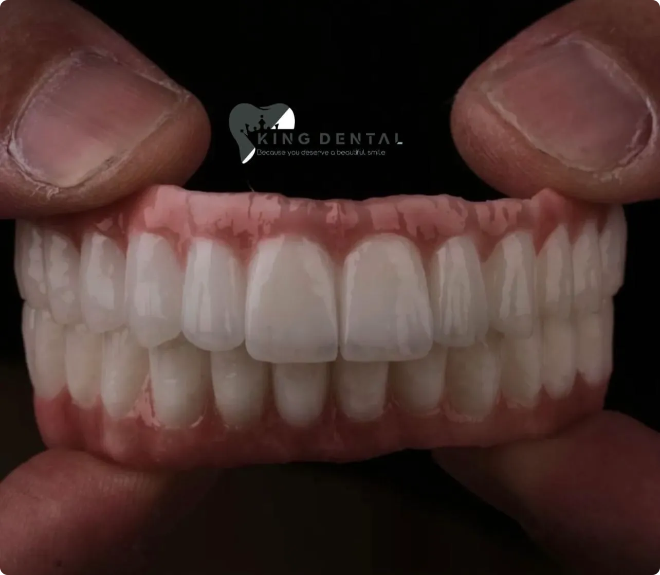 Prosthodontics Portfolio 4