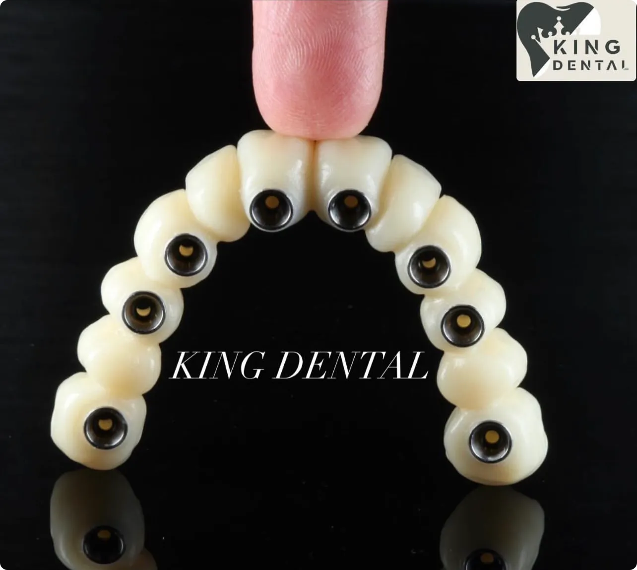 Prosthodontics Portfolio 6